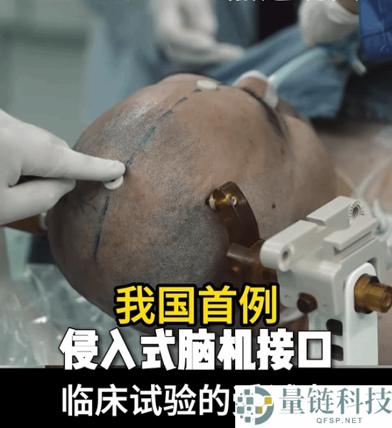 我国成功完成首例侵入式脑机接口手术 意念玩游戏