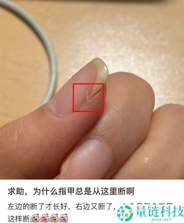 指甲为什么总从这个处所断开 是缺钙了吗