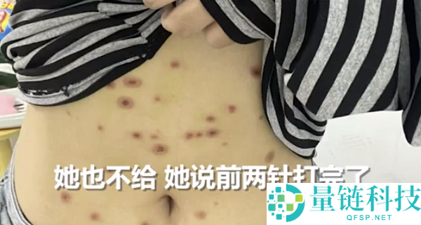 女生800元买猫被传染全身长猫藓 医治破费已近千元