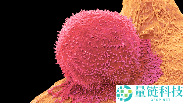 研讨发现大腿粗的人或自带抗癌优势：这才是宝藏身段