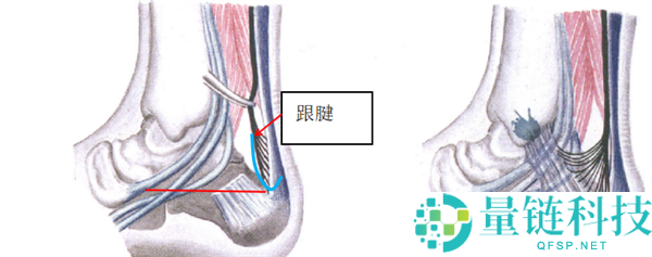 为什么有的人脚脖子粗 有的人脚脖子细？