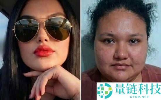 男子照片美颜过度致失踪 4 天难寻：寻人启事为何找不到人？