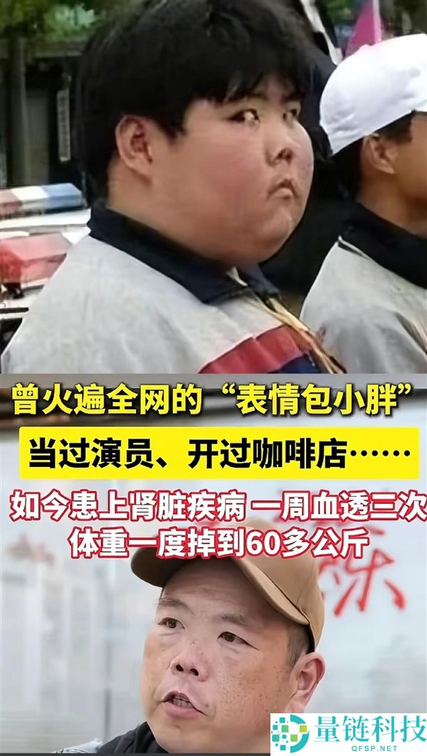 网红小胖一周透析 3 次：曾因表情包爆火，自称要做“嘚瑟的病秧子”