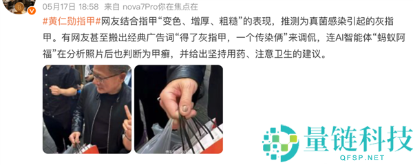 黄仁勋指甲被网友云诊断灰指甲？医生回应：科技大佬也躲不过