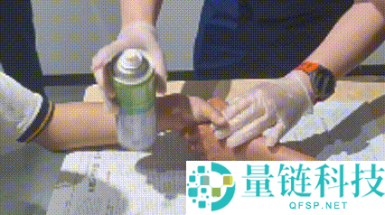两男生手被 502 胶水粘住 2 小时，医生束手无策，最终 119 成功解救