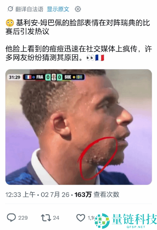 “姆巴佩脸部变化引发热搜：专家博主揭秘背后真相”