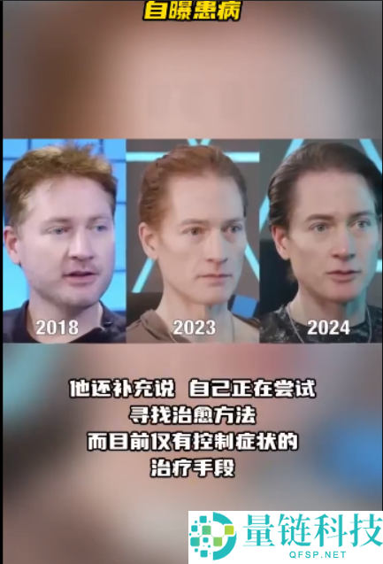 美国亿万富翁为求生进行基因克隆,换血失败后的奇妙转变