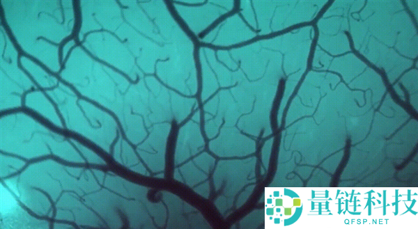 1.5秒植入,马斯克脑机接口公司手艺新打破 超万人守候上脑