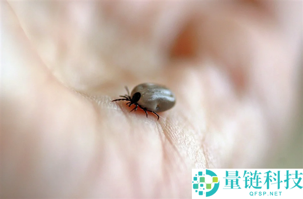 美飞翔员户外被蜱虫叮咬 14天后吃烧烤+汉堡暴毙而亡