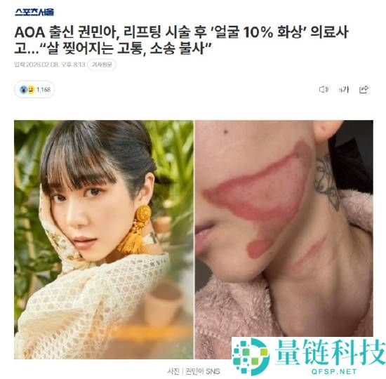 烧的太惨烈,韩国女星做医美居然致使面度灼伤