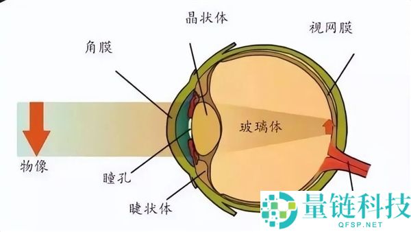 直视太阳 10 分钟视力骤降至 0.4！男子“晒眼睛”突发奇想酿大祸