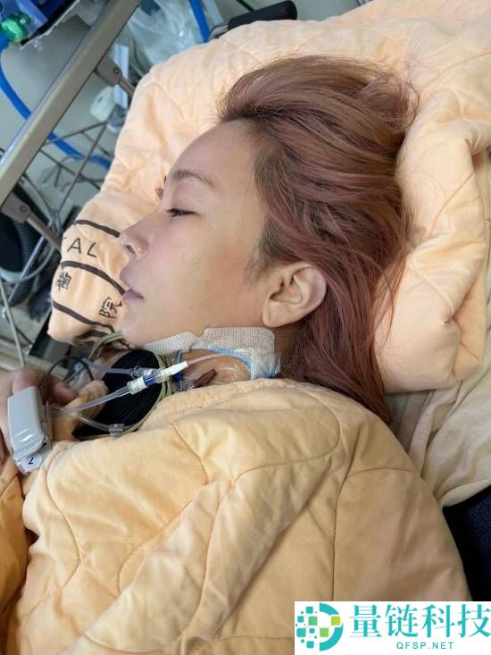 温岚突发败血症进 ICU！闺蜜曝病前仅吃 3 个苹果，健康警钟敲响