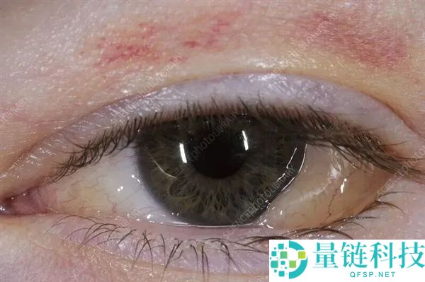 避免这4个“毁眼”行为，保护视力的必做事项