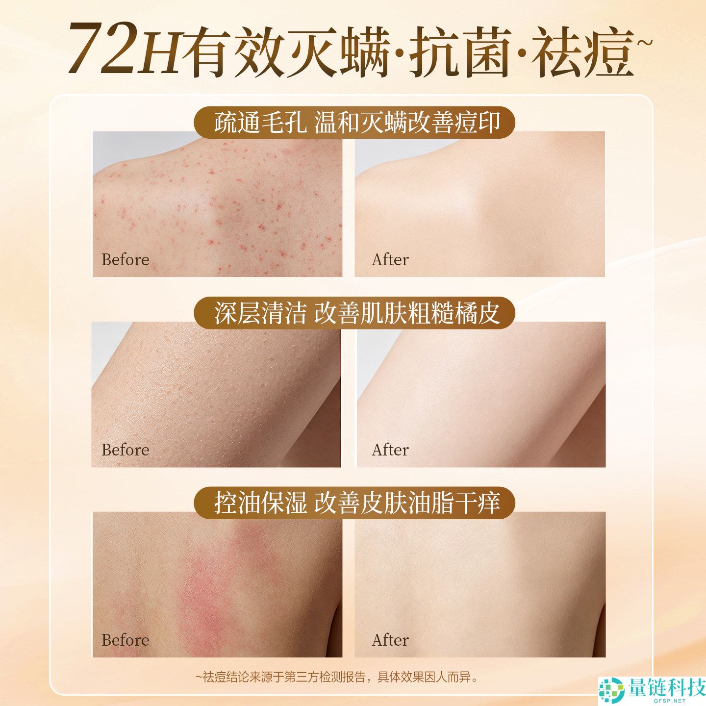 纳爱斯硫磺液体香皂大促：杀螨除菌祛痘，1升仅需19.9元！